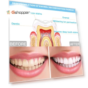 Wire Control Tooth Set Accessories — Orthodontic Care Essentials