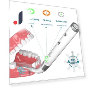 Dental Implant Detection System — Tools & Accessories, AI DENTAL