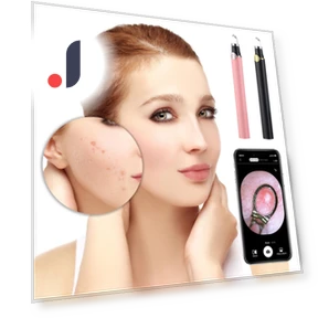 Smart Visual Blackhead Remover — Blackhead & Blemish Removers, YiGeiWoLiGiaoGiao