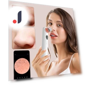 Vacuum Blackhead Remover with 1080P Camera — Blackhead & Blemish Removers, Glowmix