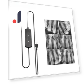 Dental Sensor with Holder — Film Processors, Jumtop