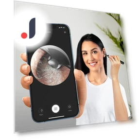 Wireless Ear Wax Camera — Wax Removal, Home Whispers