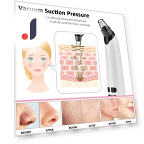 Facial Cleaner — Blackhead & Blemish Removers, Cars Auto Home