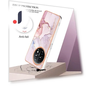 TPU Case with IMD Marble Pattern Electroplated Back Cover — Basic Cases, Smartwatch 2025