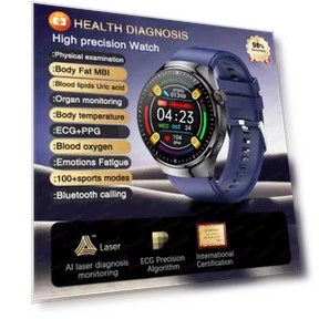 High Precision ECG Blood Lipids Uric Acid Risk Assessment Smart Watch — Smartwatches, SAMS Online