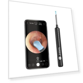 Smart Visual Ear Spoon — Endoscopes, BEBIRD