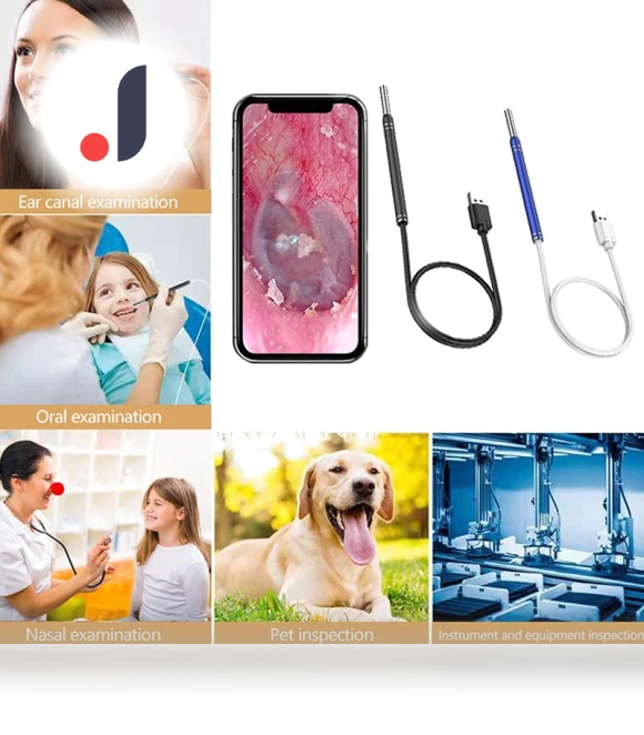 Smart Visual Ear Cleaner Endoscope — Syringes, Paddya