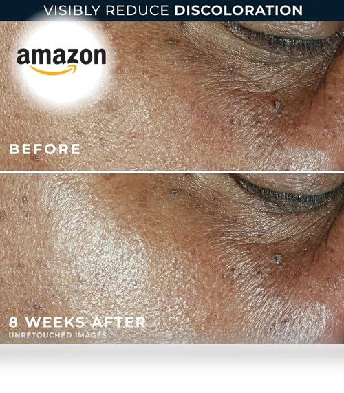 5 in 1 Anti-Aging Daily Face Moisturizer — Facial Hydration, RoC