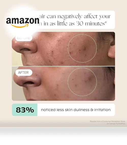 Bedside Humidifier — Air Moisturizers, Canopy