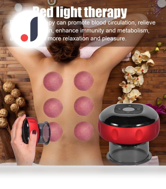 Electric Vacuum Cupping Massage Tool — Blackhead & Blemish Removers, zhusong