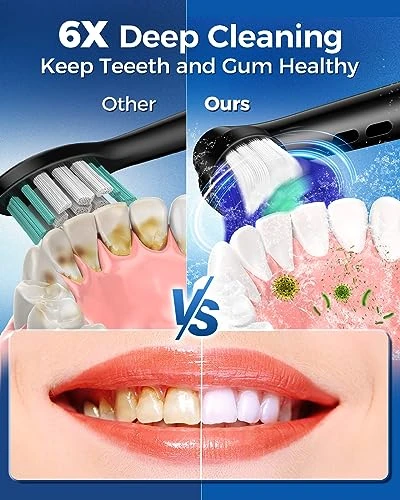 Rotating Electric Toothbrush for Adults — Electric Toothbrush Heads, TEETHEORY