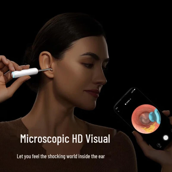 Smart Visual Ear Cleaner — Electric Ear Cleaner, BEBIRD