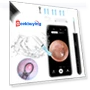 Smart Visual Ear Cleaner with HD Camera and WiFi — Blackhead & Blemish Removers, SUNUO