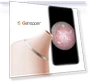 AI Visual Blackhead Remover Camera — Blackhead & Blemish Removers