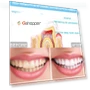 Thumbnail Wire Control Tooth Set Accessories — Orthodontic Care Essentials