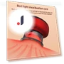 Intelligent Vacuum Massage Device — Massage Equipment, Wrigleys
