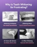 Thumbnail Whitening Electric Toothbrush — Electric Toothbrush, Bixdo