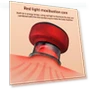 Intelligent Vacuum Massage Device — Massage Equipment, Wrigleys