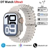 Smart Watch with Amoled Display, PRISMA