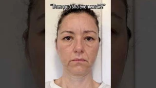 Does gua sha even work? You tell us!