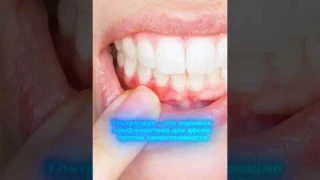 Ультразвуковые зубные щетки