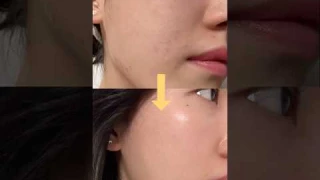 One skincare gadget I can't live without #shorts