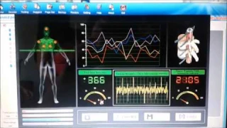 Quantum Resonance Magnetic Analyzer (QRMA) is a crap!!! DONT BUY IT!!