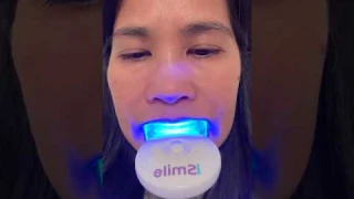 iSmile LED Light Activated Whitening Teeth kit #ismile  #whitening