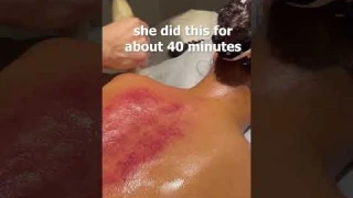 ASMR: Insane Chinese Horn Guasha! #shorts