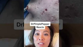 Interesting she used a skin hook in this way. ⁠