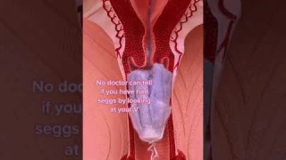 Can you lose your virginity with a tampon? #shorts