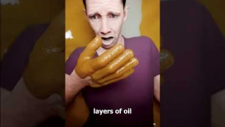 What If You Fell Into A Blackhead? 😳