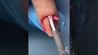 WATCH ME FIX MY CLIENTS NAIL🤢💅🏼(OMG)😳
