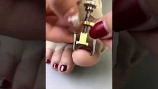 Correct and Care Ingrown Toenail Straightening and Pedicure Tools #nailrepair #manicureset