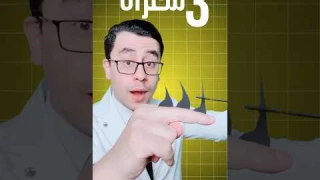 افضل ليزر منزلي