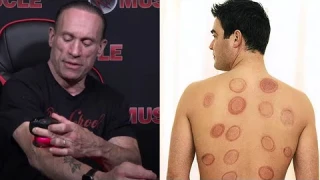 Does CUPPING Really Work? Dave Palumbo's Achedaway Cupper Review