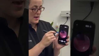 How To Use An Ear Camera:  Do You Have Ear Wax?