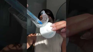 What 10 mins can do to your teeth? #mysmile #teethwhitening #fyp #viral #beauty