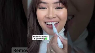 Try our teeth whitening pen to get a whiter smile 🦷 #whitesmile #perfecteeth #teethwhiteing #shorts