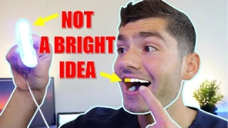 7 Day Teeth Whitening Results !!
