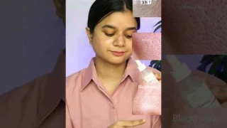 The Ordinary Niacinamide 10% + Zinc 1% Review | Open Pores, Oily skin, bumpy skin