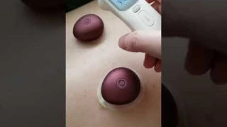 GX Electric Heating Moxibustion Patch Review, Electronic Hot Stones