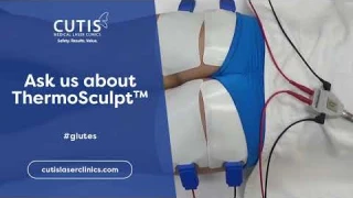 Look Great in Yoga Pants with ThermoSculpt™