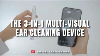 SUNUO FIND X : THE 3-IN-1 MULTI-VISUAL EAR CLEANEING DEVICE | Kickstarter | Gizmo Hub