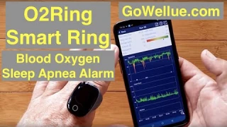 Wellue O2Ring™ Smart Ring Dynamic HR, Blood Oxygen, Sleep Apnea, Vibrate Alarm: Unboxing & Review