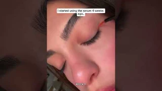 This lash serum works in everyone