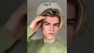 Trying rosemary oil for 2 weeks the results…