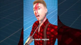 How Chainsaw Kickback Works 😬