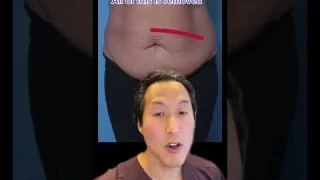 Watch This Tummy Transformation! #shorts #tummytuck