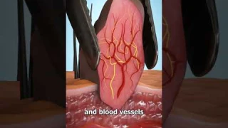 What Is A Skin Tag? 😨